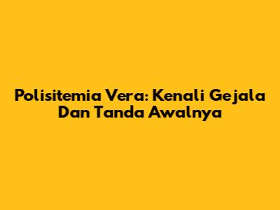 Polisitemia Vera: Kenali Gejala Dan Tanda Awalnya